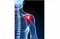 Shoulder Injuries