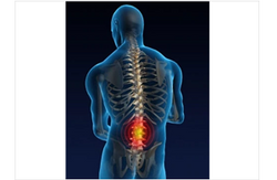 Back Injuries & Conditions