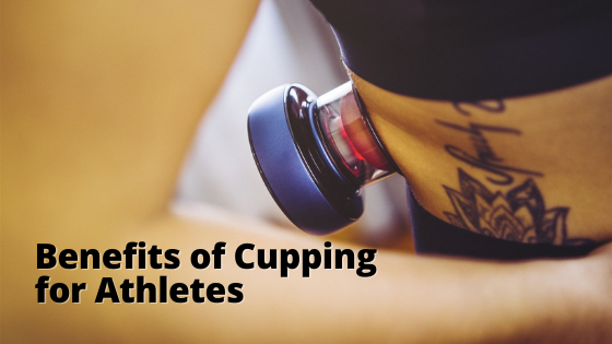 Why Athletes Should Try Cupping Therapy SourceOrtho
