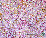 Dog Kidney Disease Under the Microscope Dog Kidney Disease Under the Microscope