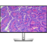 How to Calculate Microscope On-Screen Magnification How to Calculate Microscope On-Screen Magnification