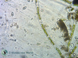 Paramecium Microscope Project Paramecium Microscope Project
