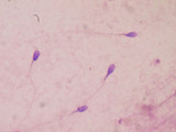 Andrology Semen Analysis Microscopes Andrology Semen Analysis Microscopes