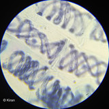 Spirogyra Under the Microscope Spirogyra Under the Microscope
