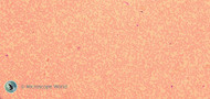 Microscope Resolution Explained Using Blood Cells Microscope Resolution Explained Using Blood Cells
