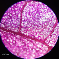 Bougainvillea Under the Microscope Bougainvillea Under the Microscope