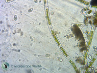 Paramecium Microscope Project Paramecium Microscope Project