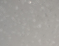 Can I See Bacteria Under a Microscope?