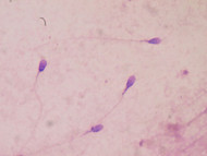 Andrology Semen Analysis Microscopes Andrology Semen Analysis Microscopes