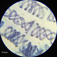 Spirogyra Under the Microscope Spirogyra Under the Microscope
