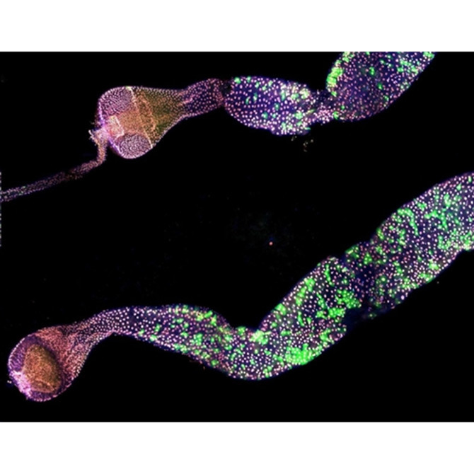 Aurox Clarity Spinning Disk Confocal