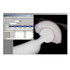 PAX-it Basic Measure Microscope Imaging Software