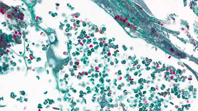Hematology Microscopes Hematology Microsocpes