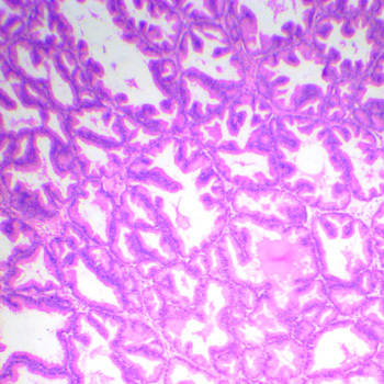 Prostate Gland Microscope Prepared Slide