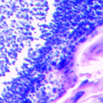 Tonsil Prepared Microscope Slide