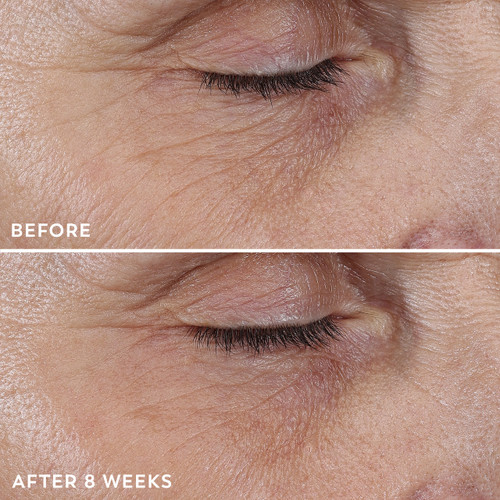Model showing before and after 8 weeks using Regenerist Micro-Sculpting Cream Moisturizer.