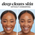 2 images model showing before and after. Deep cleans skin without over drying.