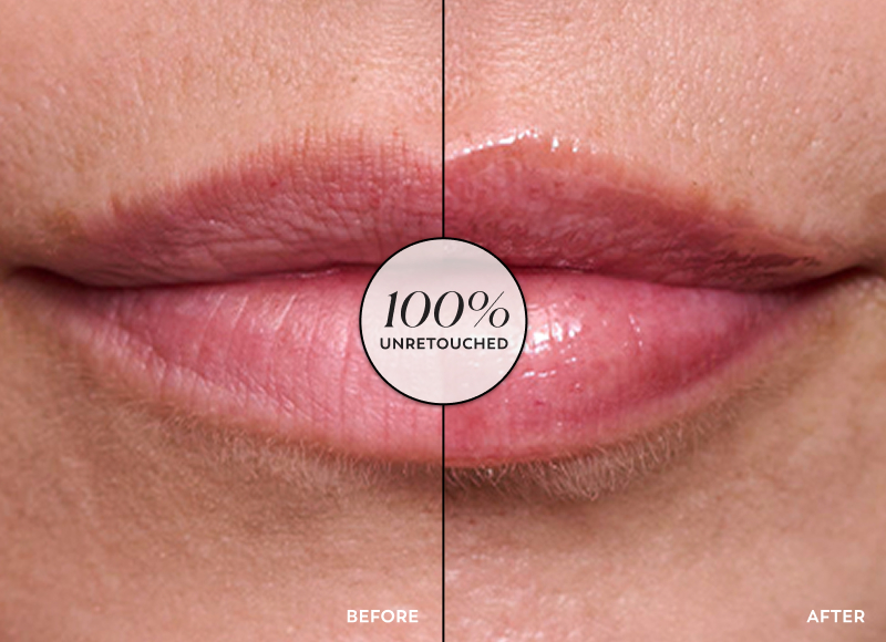 A before and after image splitting a woman’s lips in half where the left side shows the before and the right side show the after where the unretouched images show fuller looking lips after using the Olay Lip Plumper Treatment