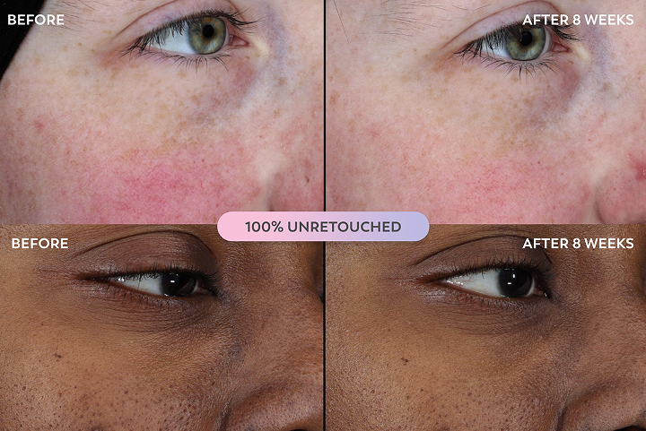 Clinically Tested & proven