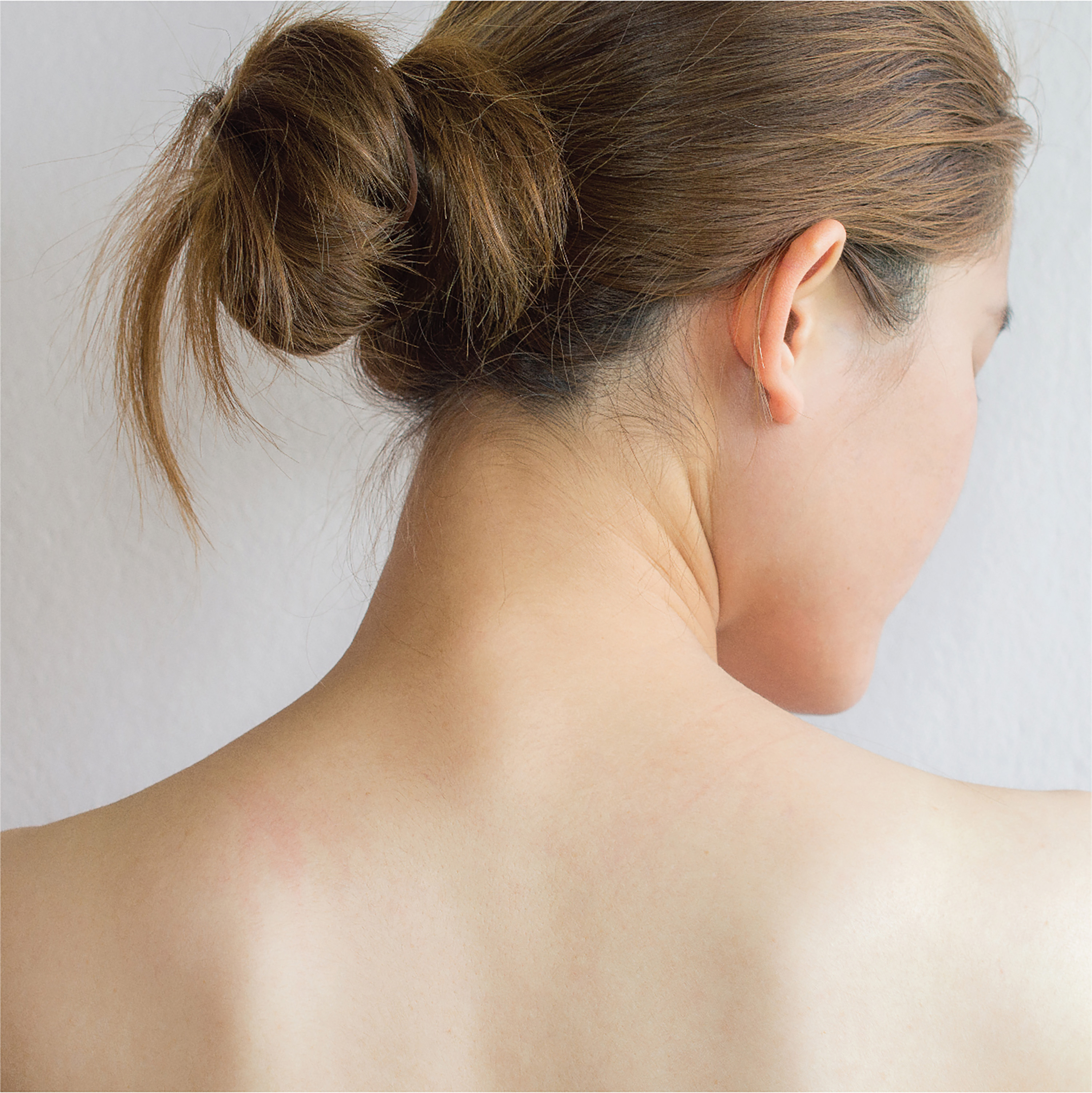 How to Banish Back and Chest Acne - Treatments for Body Acne