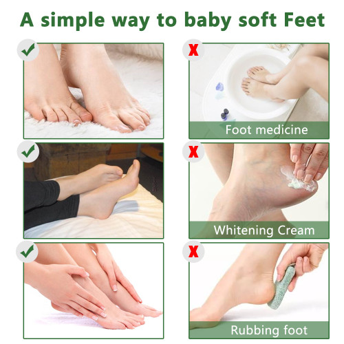 Tea Tree Foot Peel Mask Removes Calluses & Softens Dry Skin | Qty 5 PCS