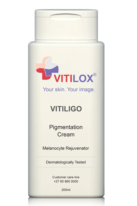 Vitilox® Vitiligo Pigmentation Cream Vitilox® Vitiligo Pigmentation Cream