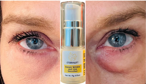 Instant Eye Bag Puffiness And Wrinkle Remover Cream For Women And Men Made In The USA! Cruelty-Free Larger Size