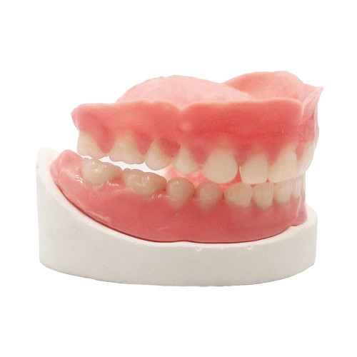 Denture Do it Yourself Full Set of Top and Bottom Fake Teeth for Improve Smile (Gypsum Model, Gum Material and Fake Teeth) Denture Do it Yourself Full Set of Top and Bottom Fake Teeth for Improve Smile (Gypsum Model, Gum Material and Fake Teeth)