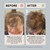ACTIIV Recover Thickening Conditioner (Unisex) | Improves Hair’s Appearance, Hydrates & Strengthens Hair, Heals Damaged & Over-Processed Hair, Plant-Based, Color-Safe, Vegan, All Hair Types, 16 oz