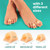 Welnove Hammertoe Corrector - 6 Pack Toe Splints - Soft Gel Toe Straighteners - Realign Bent, Curled, Crooked, Claw, Hammer Toes - Corrector for Men and Women, Large (Beige), FSA or HSA Eligible