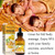 12 Pack Ginger Oil Lymphatic Drainage Massage Oil, Vitamin E Oil For Skin, Belly Lymphatic Drainage Ginger Oil -Arnica Ginger Oil for Lymphatic Drainage,Warming Sore Muscle Massage Oil Plant Aroma Oil 12 Pack Ginger Oil Lymphatic Drainage Massage Oil, Vitamin E Oil For Skin, Belly Lymphatic Drainage Ginger Oil -Arnica Ginger Oil for Lymphatic Drainage,Warming Sore Muscle Massage Oil Plant Aroma Oil
