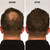 ECLIPSE Hair Fibers Auburn for Thinning Hair for Women & Men to Conceal Hair Loss in 15 Seconds - 100% Undetectable Hair Building Fibers, 30g