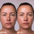 Wrinkles Schminkles Face, Neck & Décolletage Polishing Peel Pads, Skin Exfoliating & Resurfacing, Pack of 5 Towelettes