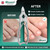Toenail Clippers by Blizzard – Medical Grade Double Action Toe Nail Nipper Cutter for Thick Nails Seniors – 6 inch German Tool Double Spring