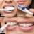Venus Visage Award Winning Teeth Whitening Pen, 20+ Uses - Teeth whitening Kit Professionally formulated - Best Teeth whitening Gel Pen Teeth Whitener - Low Sensitivity (Mint) (0.07 Fl Oz (Pack of 2))