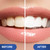 Venus Visage Award Winning Teeth Whitening Pen, 20+ Uses - Teeth whitening Kit Professionally formulated - Best Teeth whitening Gel Pen Teeth Whitener - Low Sensitivity (Mint) (0.07 Fl Oz (Pack of 2))