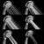 Handheld Shower Head, 6 Spray Setting High Pressure Shower Head with Brass Swivel Ball Bracket and Extra Long Stainless Steel Hose, Chrome, 5"