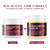 Vigority Helichrysum Balm Soothes & Repairs: Restorative Arnica Cream with Calendula for Fragile, Thin Skin & Bruise-Prone – Moisturizes, Revitalizes & Strengthens Skin Barrier for Adult Seniors 3.4oz