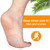 Kimihome Metatarsal Pads 8 Count Gel Cushions, Ball of Foot Cushion Protect and Relieve Metatarsal, Sesamoid, Ball of Foot Pain - 4 Pairs