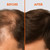 HPX ONE Anti Hair Loss Shampoo For Men - DHT Blockers: Saw Palmetto & Lupine Protein + Biotin, Keratin, Caffeine, Essential Oils & Plant Extracts - Strengthen, Thicken & Protect (8.45 Fl Oz)