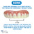 Instant Smile Secure Fit Upper Teeth Veneer -