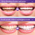 2Pcs Teeth Whitening Tablets,Purple Toothpaste Tablets,Mint Purple Toothpaste for Teeth Whitening,Fresh Breath & Oral Care & Remove Stains,Portable Cleaning Tablets (B)