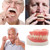 Denture Do it Yourself Full Set of Top and Bottom Fake Teeth for Improve Smile (Gypsum Model， Gum Material and Fake Teeth)
