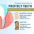 UNITEIN Gum Restore Toothpaste, Improves and protects damaged & bleeding gums, Breaks Down Plaque, Resists Tarter, Plant-based Formula, 99% Natural Ingredients, Free of Fluoride, Triclosan, Microbeads
