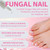 Toenail Fungus Treatment Extra Strength,Antifungal Solution for Toe Nail or Fingernail,Triple Action Formula for Remove Fungal, Renewal and Strengthen Nails,0.5 Fl Oz(Pack of 2)