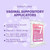 SEROVERA Seroflora Boric Acid Vaginal Suppository Applicators, Sterilized & Individually Wrapped, Fits Boric Acid Suppositories, Size 0 & 00 Capsules, Vaginal Tablets & Pills, (7 Pack) Made in USA. SEROVERA Seroflora Boric Acid Vaginal Suppository Applicators, Sterilized & Individually Wrapped, Fits Boric Acid Suppositories, Size 0 & 00 Capsules, Vaginal Tablets & Pills, (7 Pack) Made in USA.