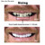 Instant Smile Comfort Fit Flex Natural Shade