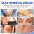 Scar Removal Cream - Advanced Scar Treatment Gel for Surgical Scars, Acne Scars, C-Section, Burns, Stretch Marks - for Old and New Scars