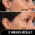 Miracle Stretched earlobe Corrector shrinking oil fix torn and stretched piercing hole no more ear lobe support patches for earrings Miracle Ear Lobe-1765345940