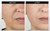 DNA Code®- No Needle Alternative-Argireline NeuroPeptides Wrinkle Reduce Moisturizer+Matrixyl 3000, Syn-Ake, SNAP-8, Copper Peptides